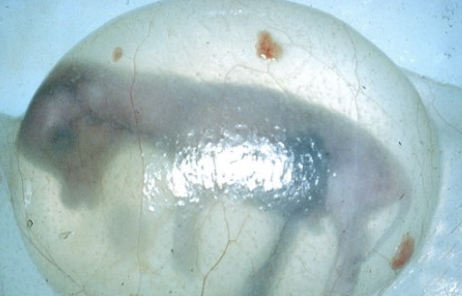 <p>may be associated with atresia coli of fetus</p>