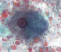 <p>What is this trophozoite of?</p>