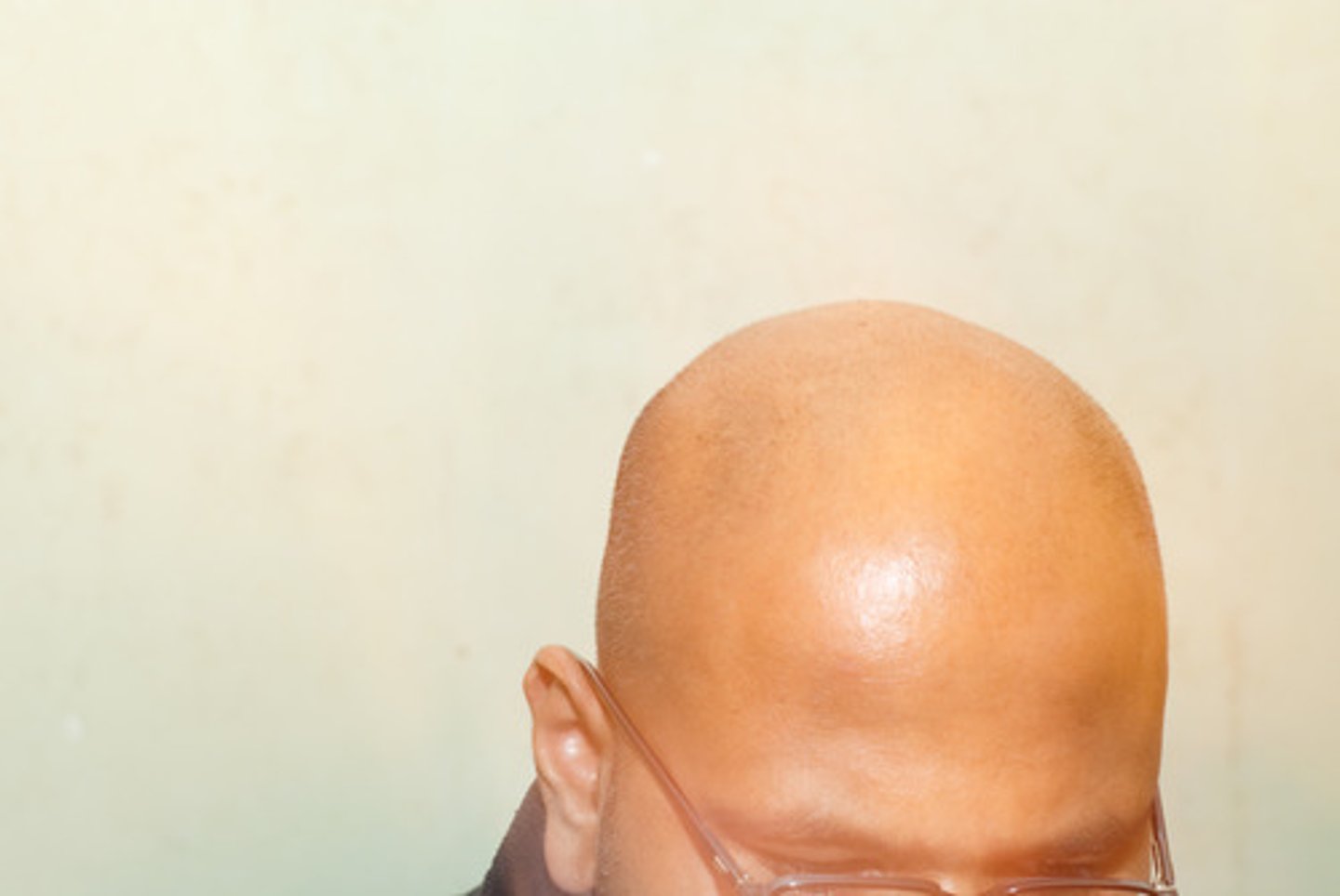 <p>(n) the skin covering the head, excluding the face.</p>