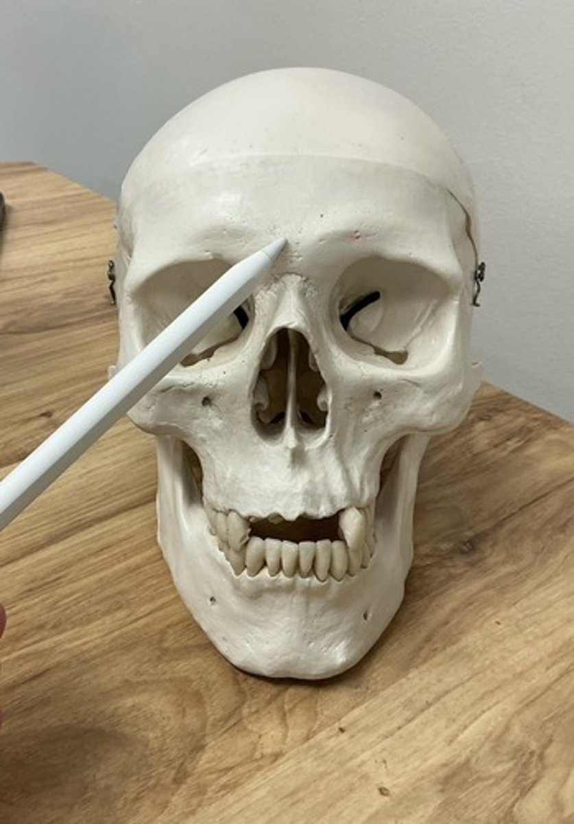 <p>What feature is this?</p>