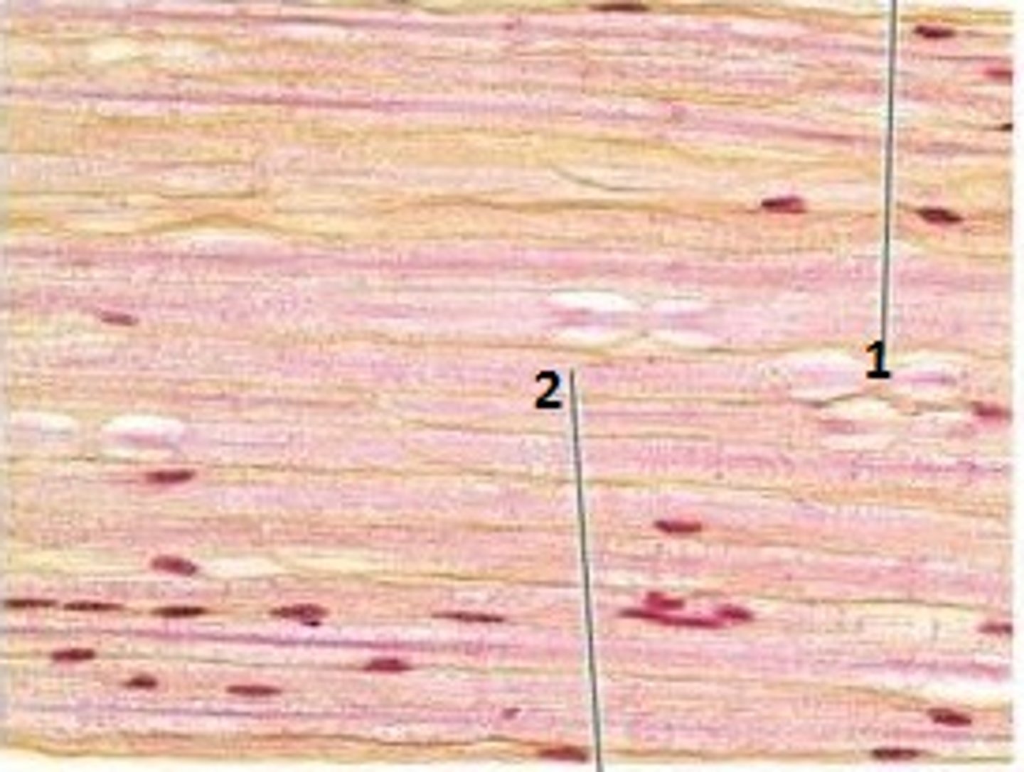 <p>Label 2 (pink area)</p>