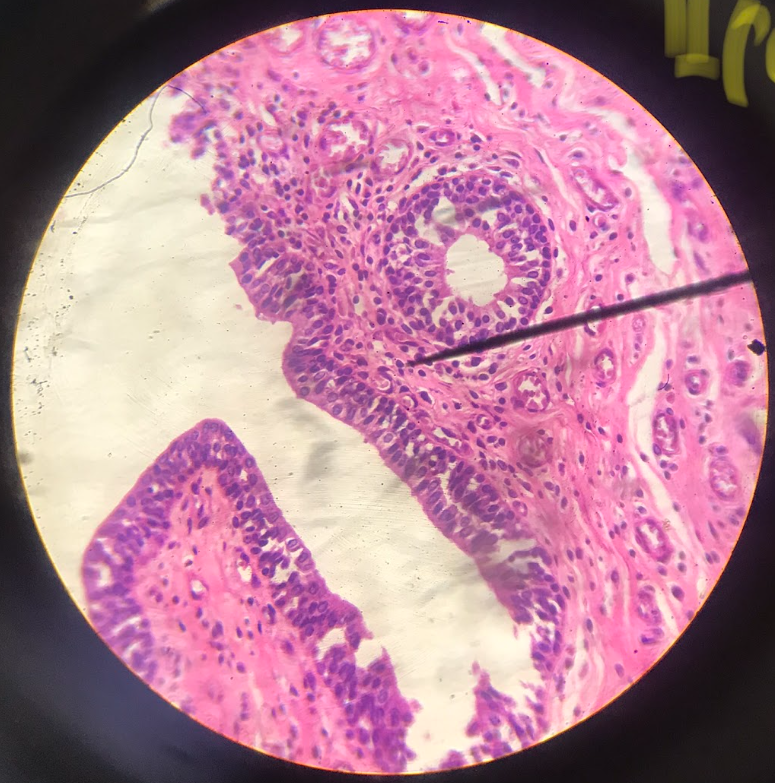 <p>corpus spongiosum; cells at the surface are columnar in form</p>