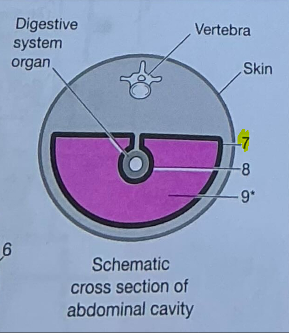 <p>Outermost layer of serous membrane that lines abdominopelvic cavity</p>