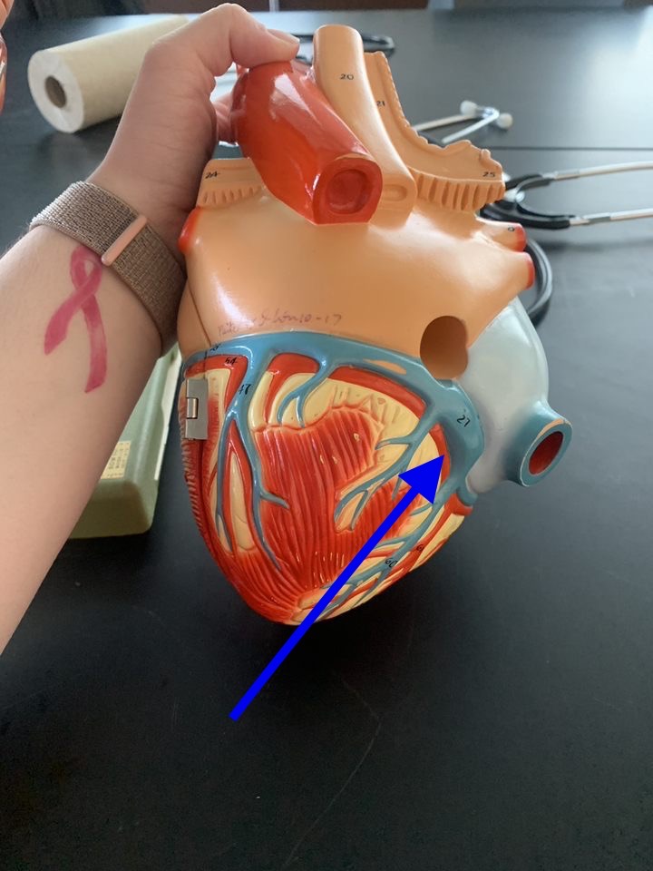 Name the heart structure.