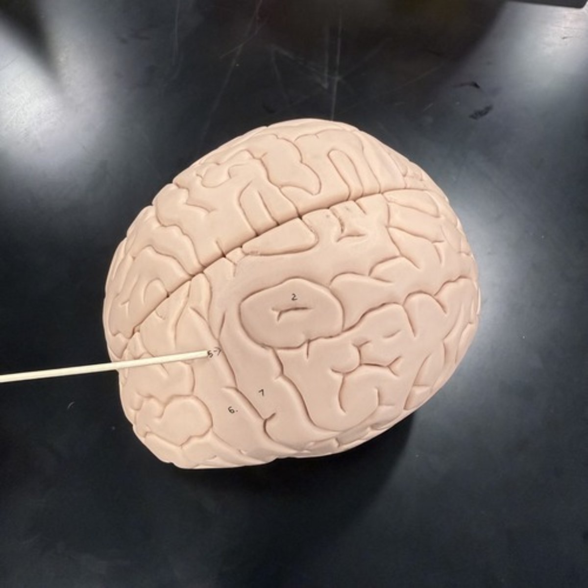 <p>What is this shallow groove?</p>