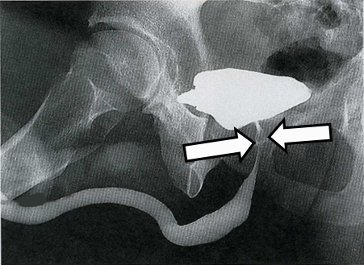 <p>What is indicated in the image?</p>