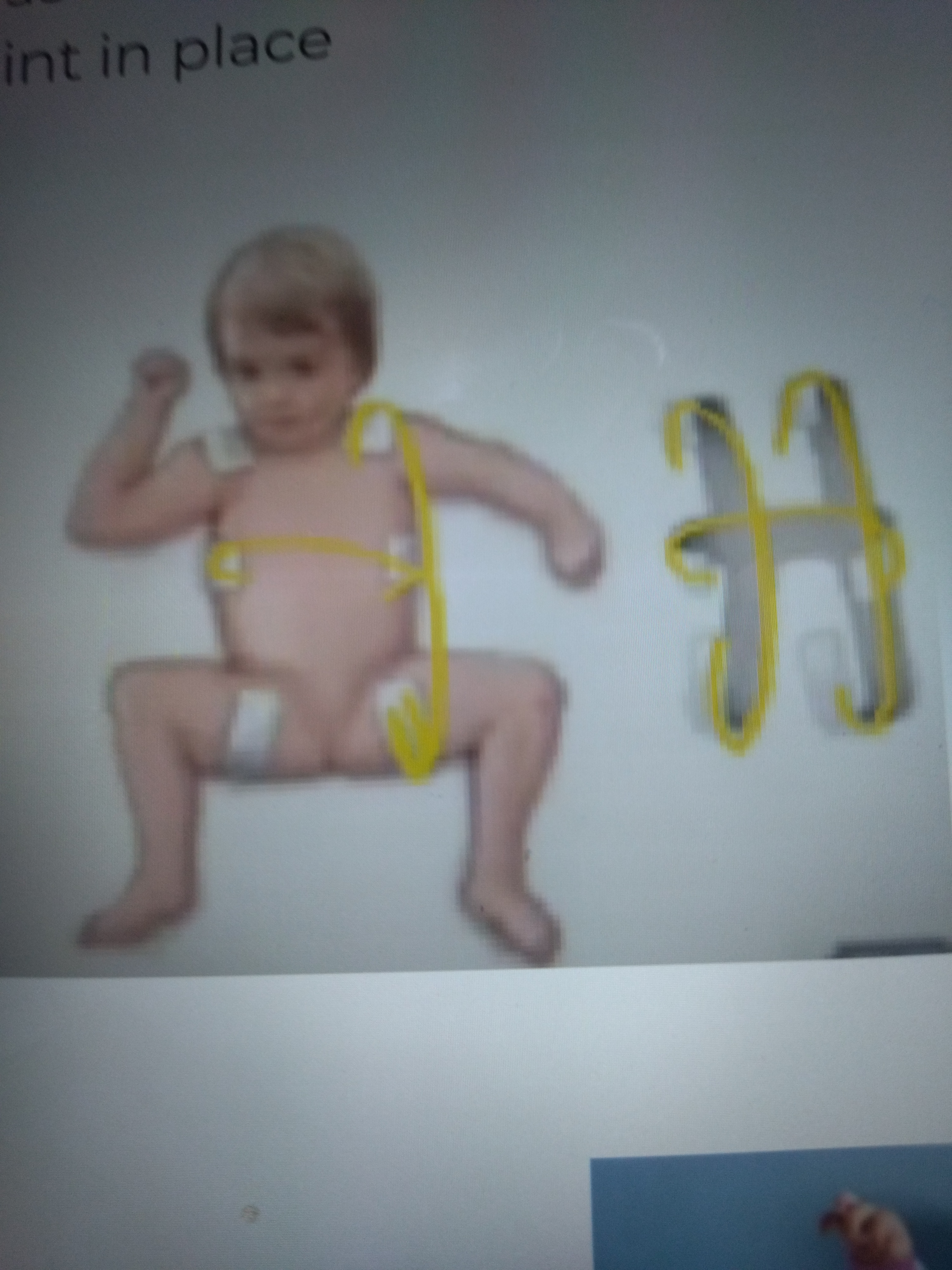 * Has vertical strap
* Ranges from shoulder to thigh
* Also has horizontal trunk strap for securing the splint in place