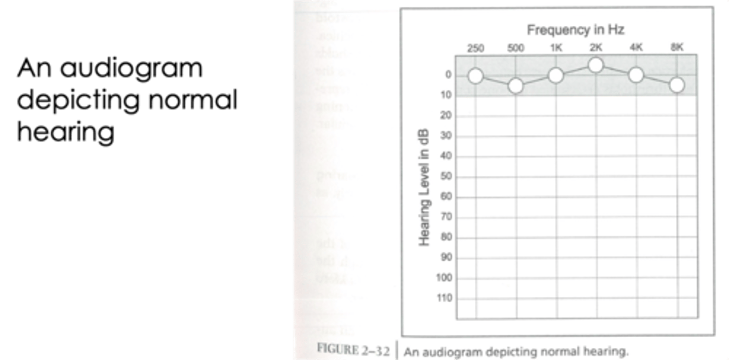 <p>lying in 0-10 dB</p>