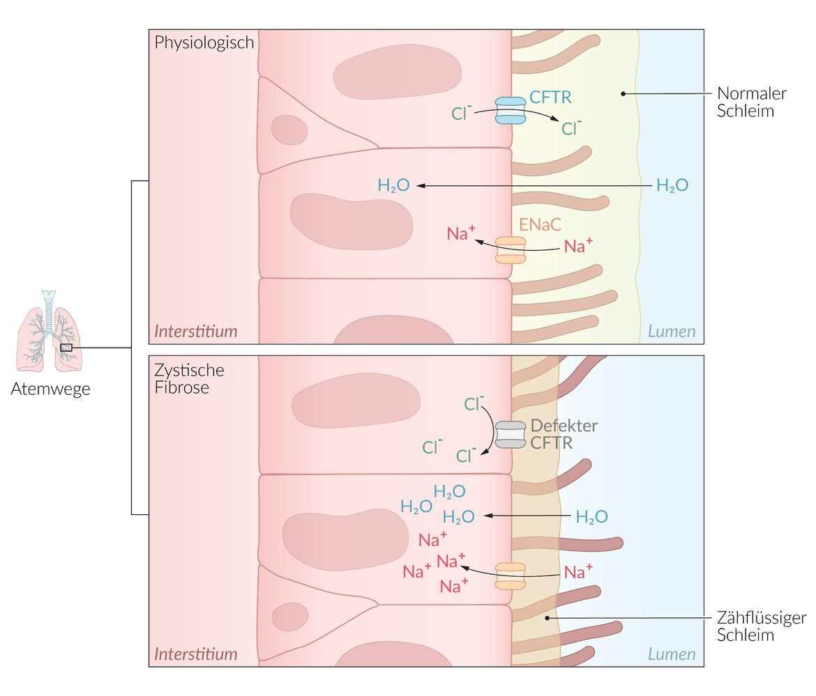 <p>A. Increased susceptibility to infections</p>