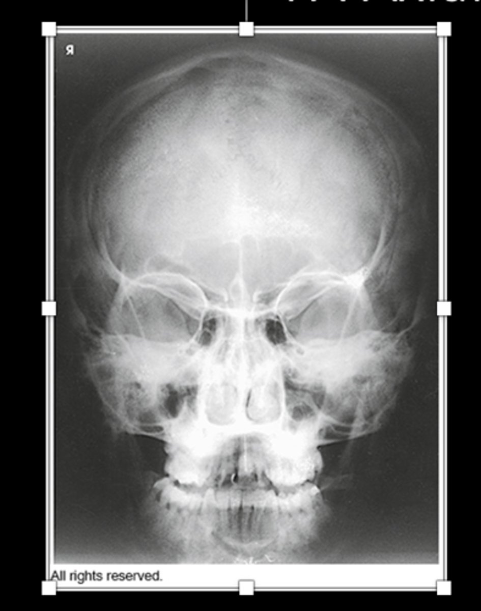 <p>What projection is this?</p>