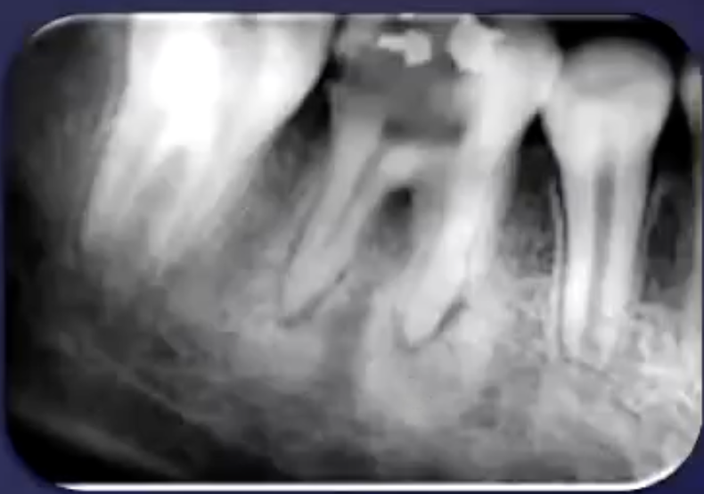 <p>describe the pathology&nbsp;</p>