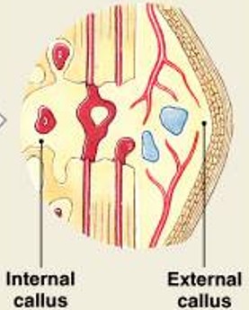 <p>Which step of fracture repair have:</p><ul><li><p><span style="color: yellow;"><strong>Osteoblasts</strong></span></p><ul><li><p>Replace central cartilage of external callus with spongy bone</p></li></ul></li></ul><p></p>
