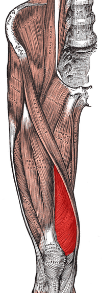 <p>Vastus Medialis Oblique (VMO)</p>