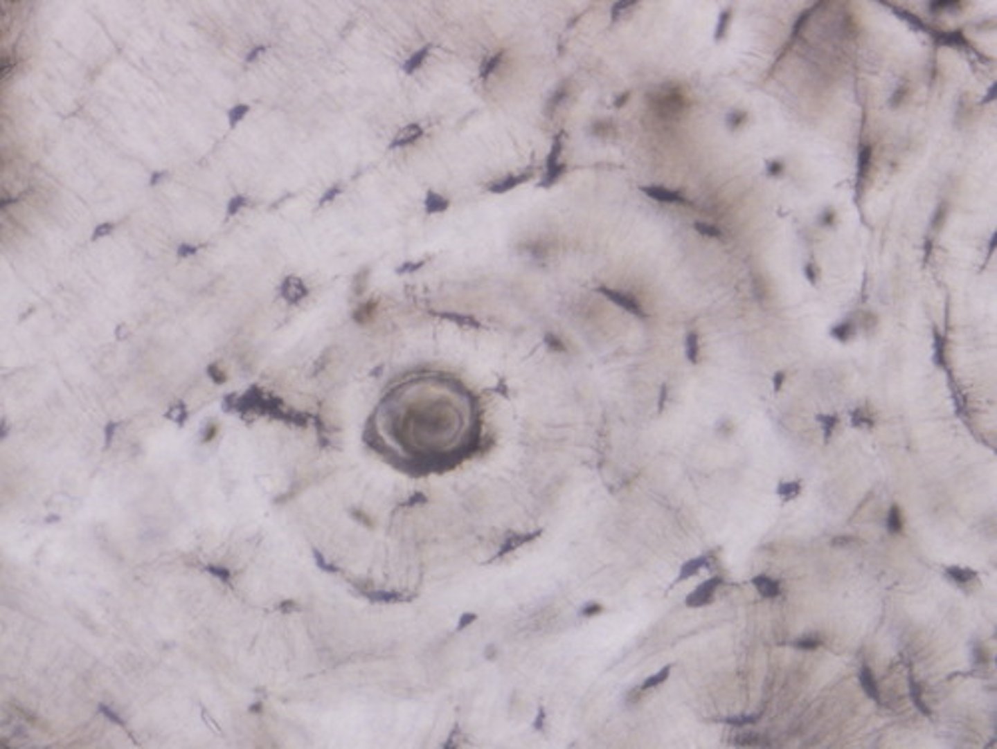 <p>Hard, dense bone tissue that is beneath the outer membrane of a bone</p>