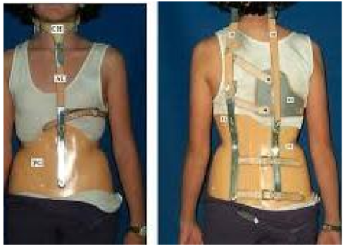 <p>Name this brace. How is it constructed?</p>