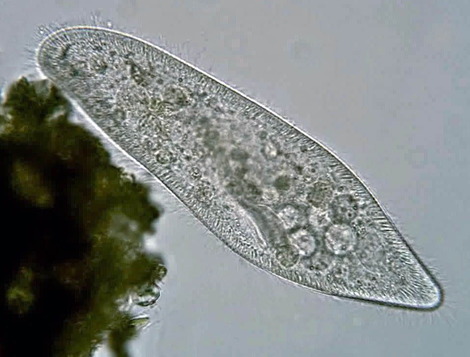 <p>What locomotory organelle is present in the image?</p>