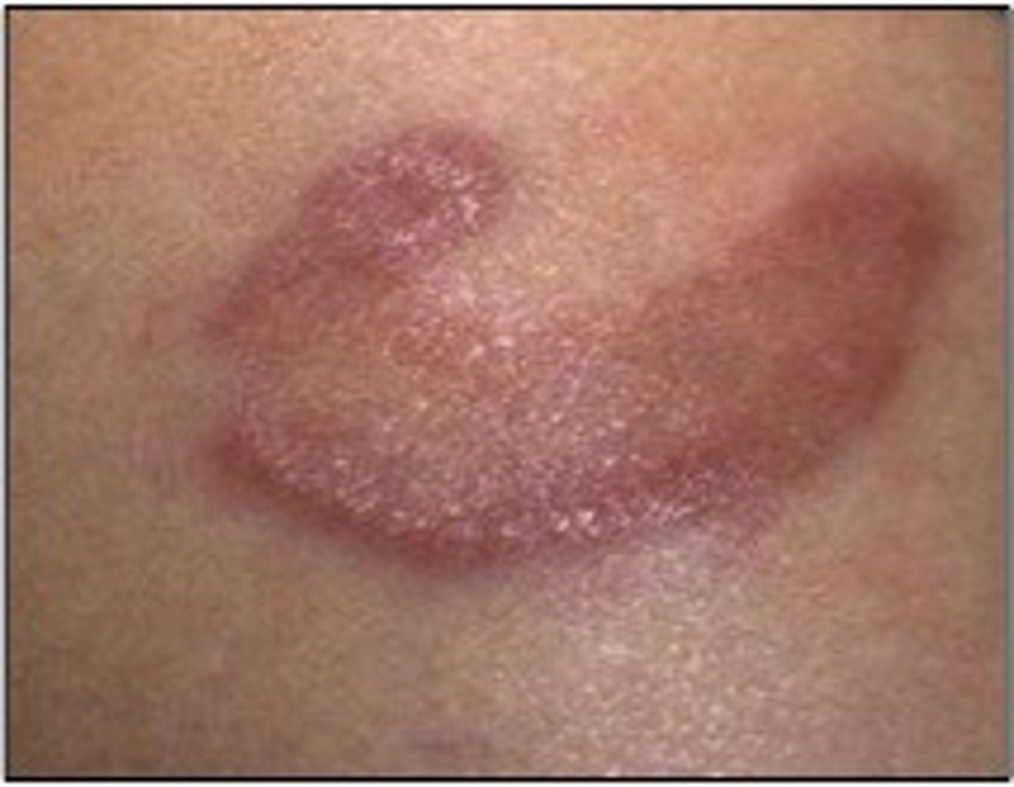 <p>Arcuate</p>