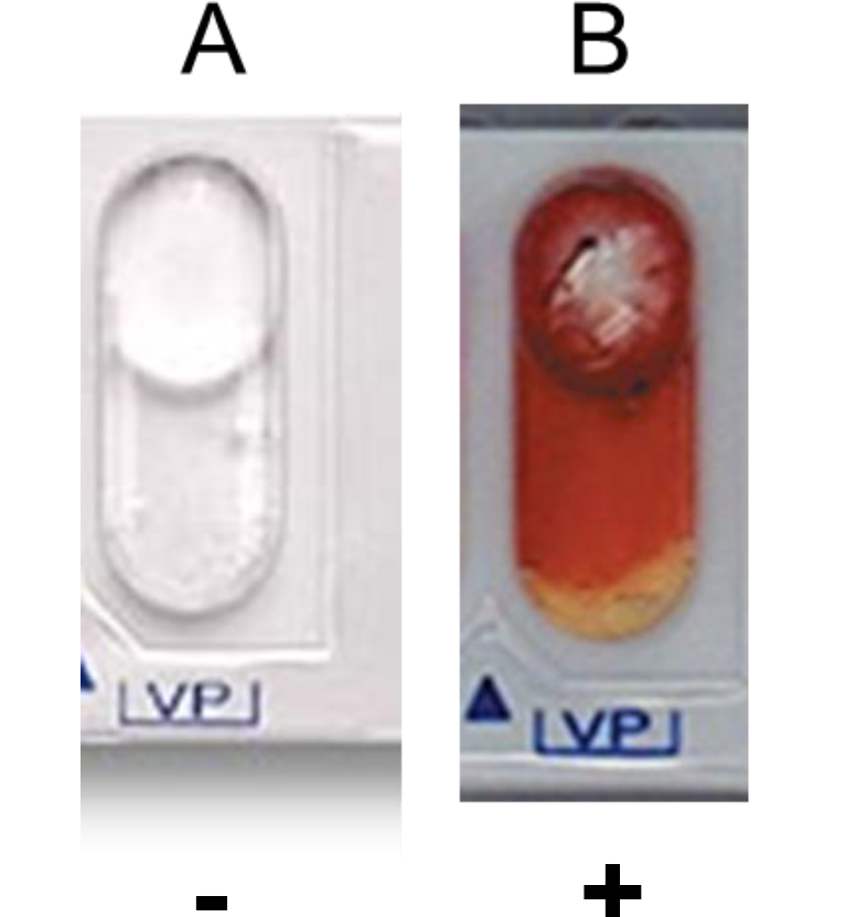 <p><strong>Voges-Proskauer (VP) Test*</strong></p><p>To determine if bacteria produce acetoin from sodium pyruvate during 2,3-butanediol fermentation</p><p><em>Requires post-incubation test - 1 drop of VPA1 and 1 drop of VPA2. Wait 10 minutes.</em></p><ul><li><p>Positive result: turns pink</p></li><li><p>Negative result: no color change</p></li></ul><p></p>