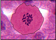 <p>What phase of Mitosis is this cell in?</p>