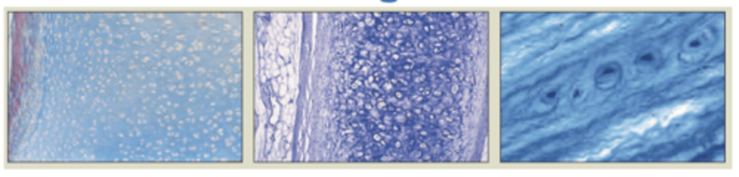 <p>Supportive CT with rubbery matrix</p><p>chondrocytes are unique cell type</p><p>Avascular</p><p>- diffusion brings nutrients and removes waste</p><p>- heals slowly</p><p>Major types (depend on fiber types)</p><p>-hyaline</p><p>- elastic</p><p>- fibrocartilage</p>