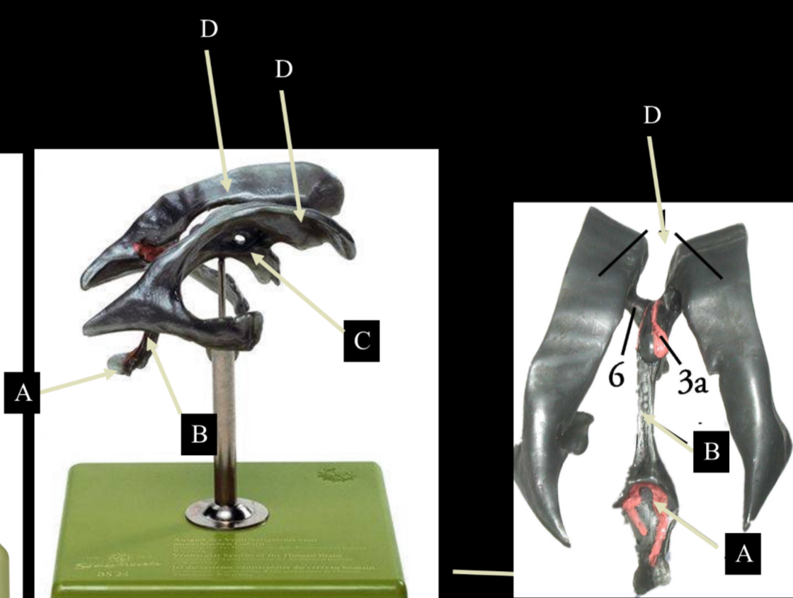 <p>lateral ventricle</p>