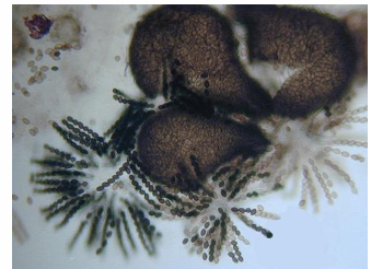 <p>Pyrenomycetes: Sordariales</p>