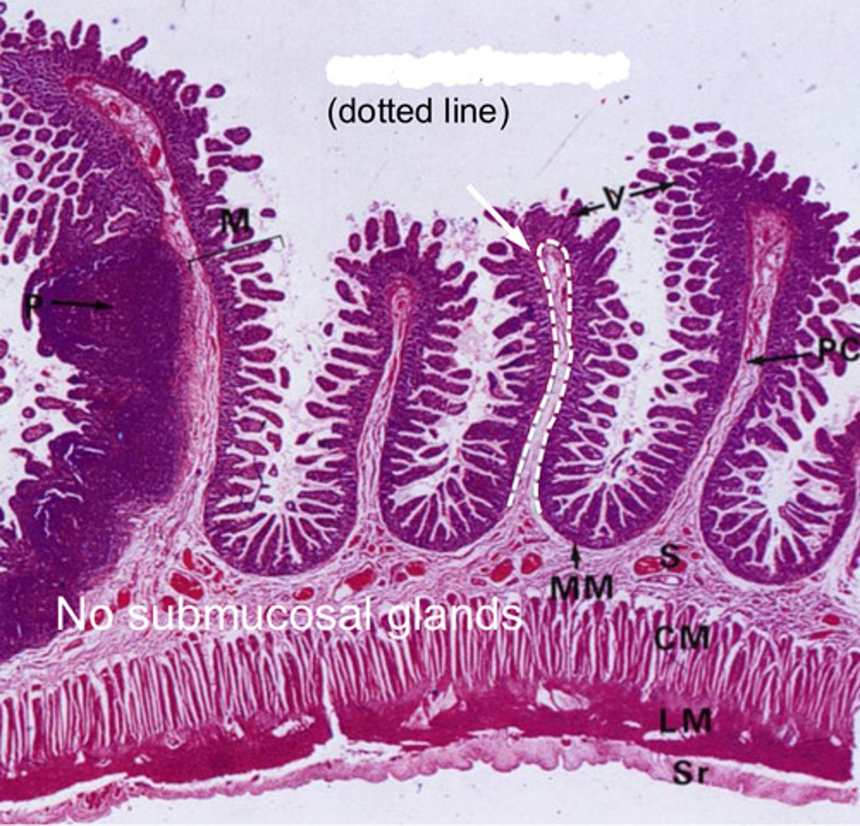 <p>muscularis mucosa</p>