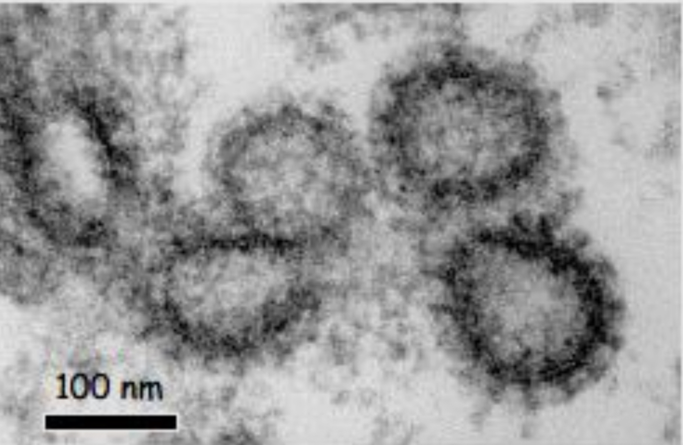 <p>À quel microscopie électronique correspond cette image de cage de clathrine </p>