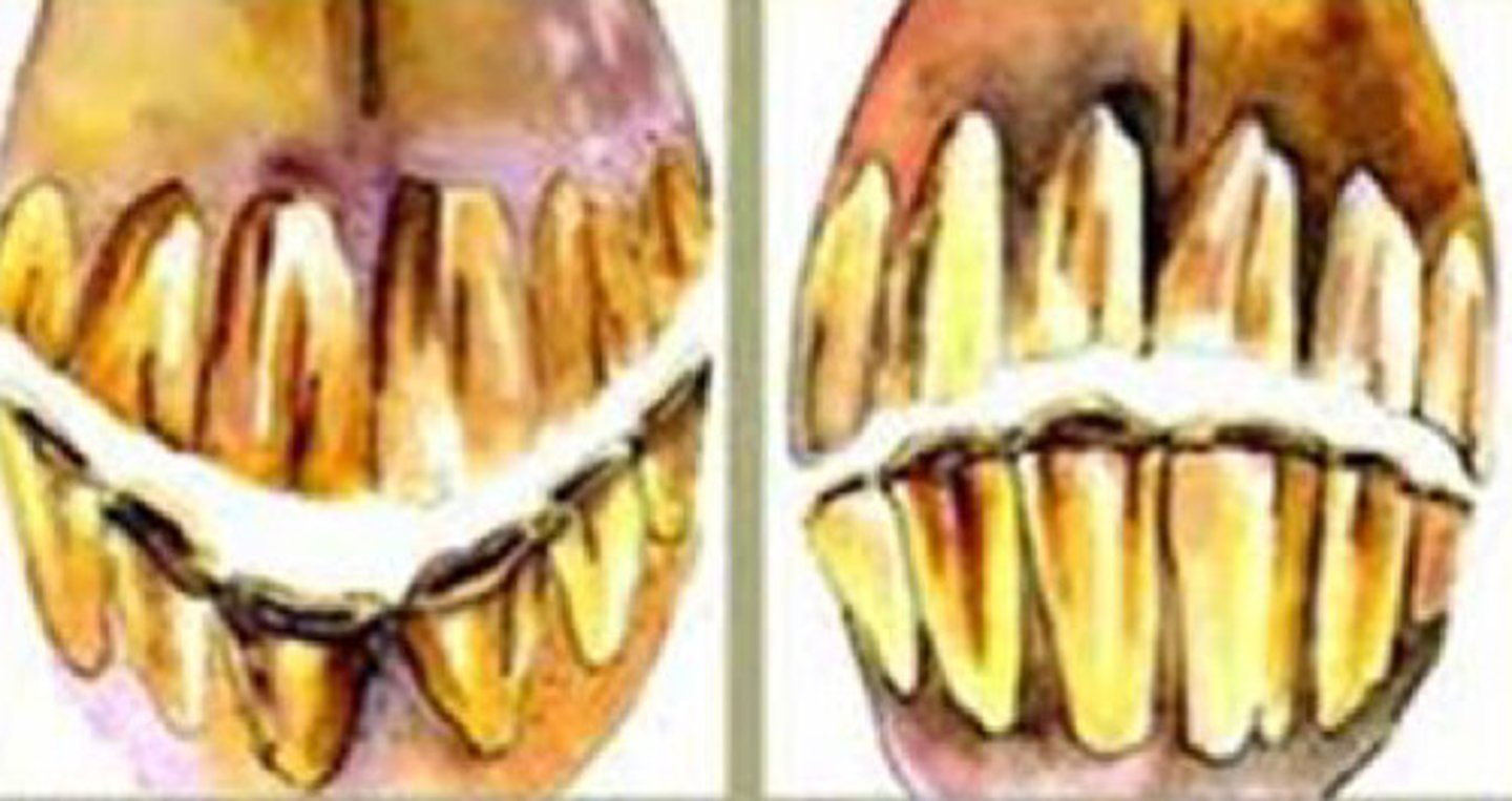 <p>Identify the pathology?</p>