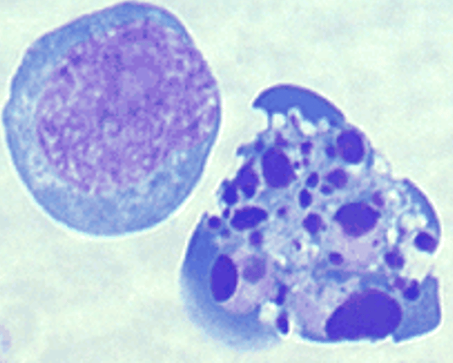 <p>What type of cell death is shown here?</p>