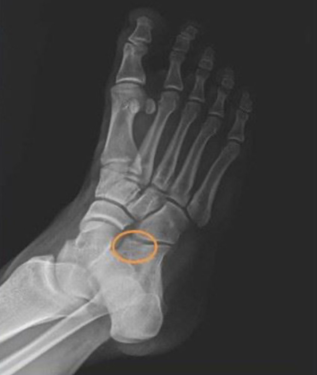 <p>oblique</p><p>3 multiple choice options</p>