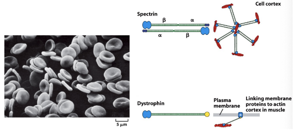 \
* Mutations in the genes encoding proteins of the red blood cell membrane skeleton (spectrin, ankyrin, band 4.1) can result in cells that rupture easily, giving rise to diseases known as hereditary spherocytic anemias. - cell shape is important
* Muscular dystrophies are genetic diseases often characterized by the progressive weakening of skeletal muscle. Duchenne muscular dystrophy (DMD) affects the protein dystrophin. Without functional dystrophin, the plasma membrane of muscle cells weakens and eventually ruptures. - membrane linkage is important