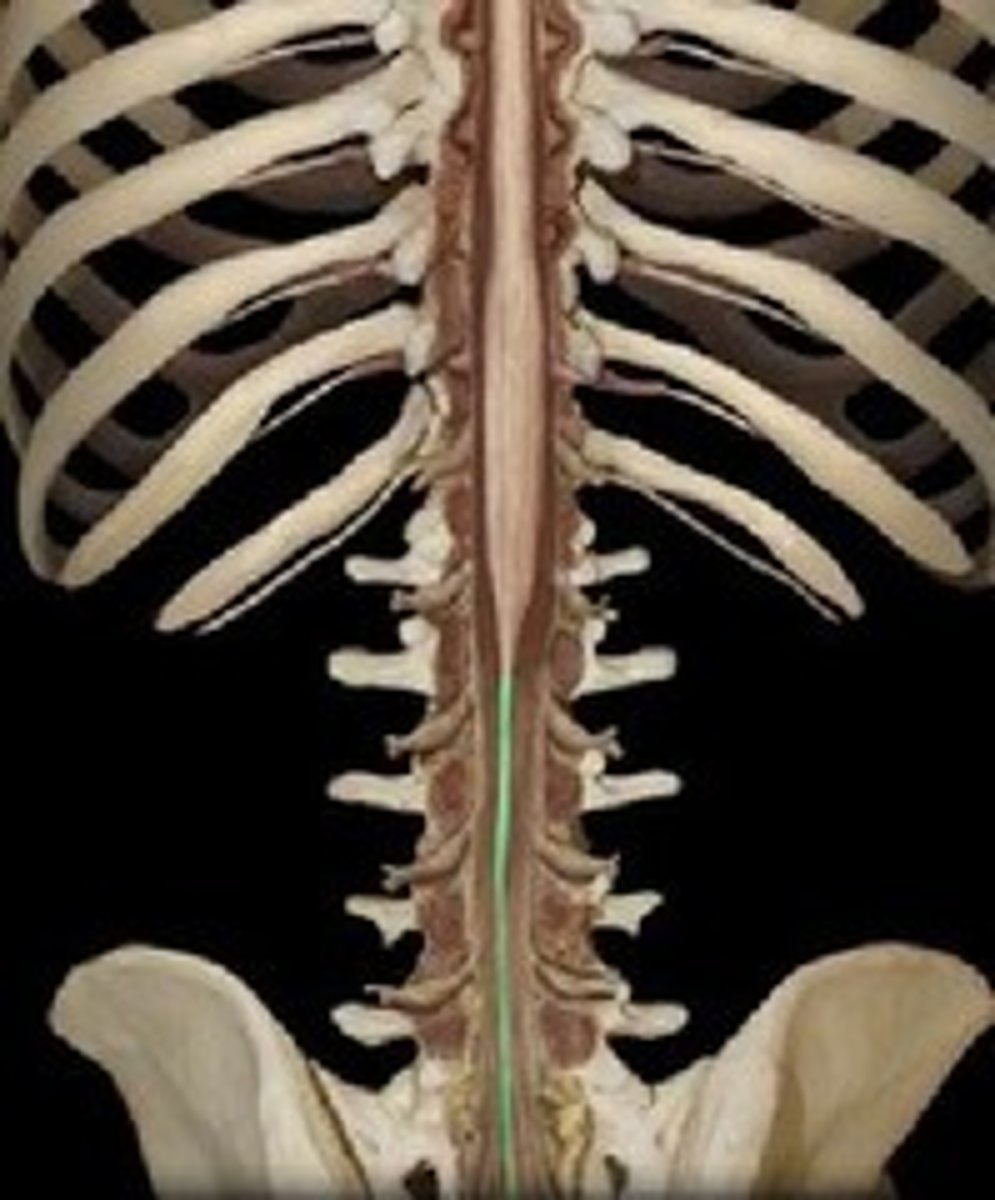 <p>anchors spinal cord to coccyx (made of spinal pia)</p>