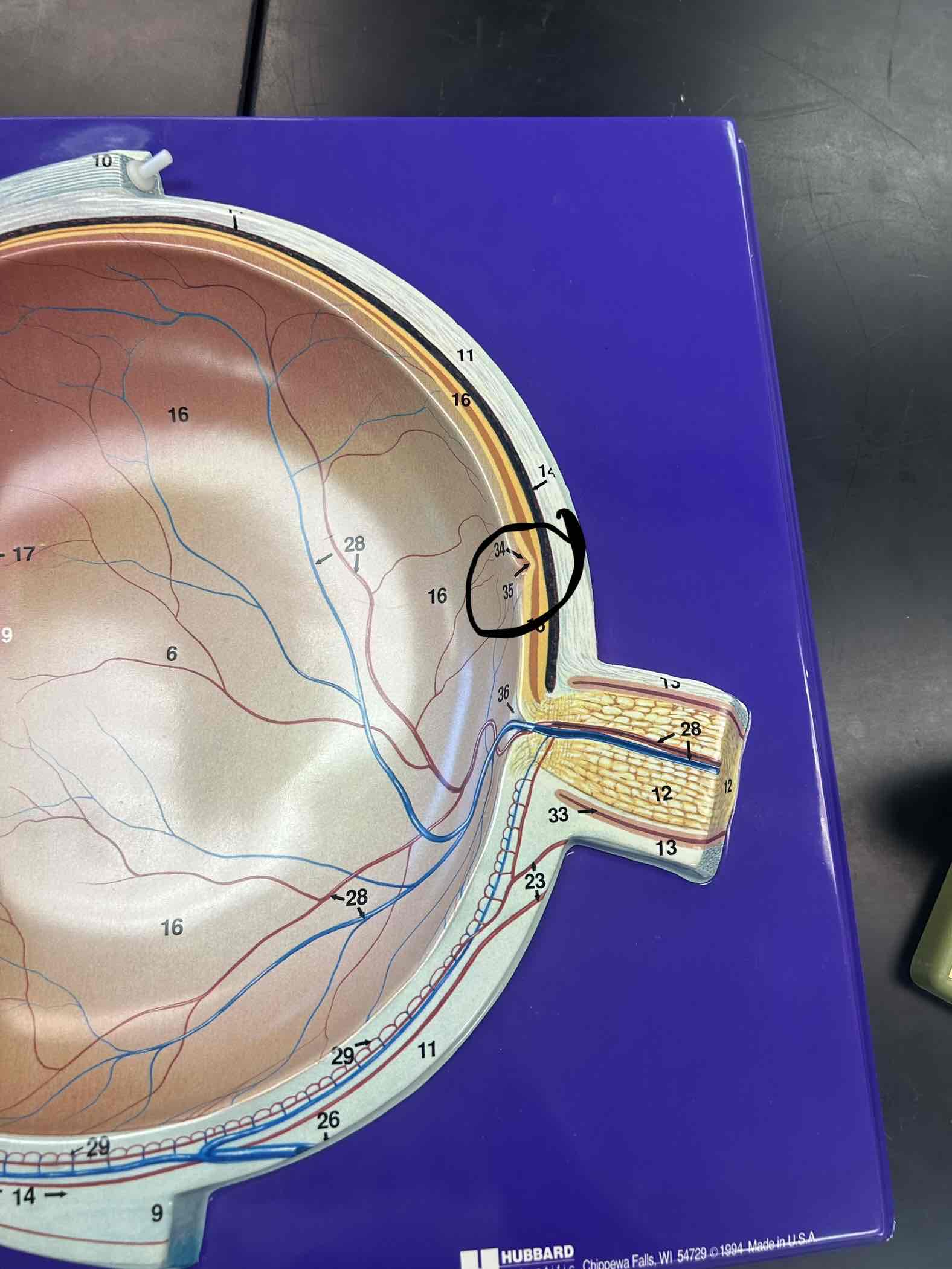 <p>Indentation on the back of the eye, but superior to the Optic Disk</p>