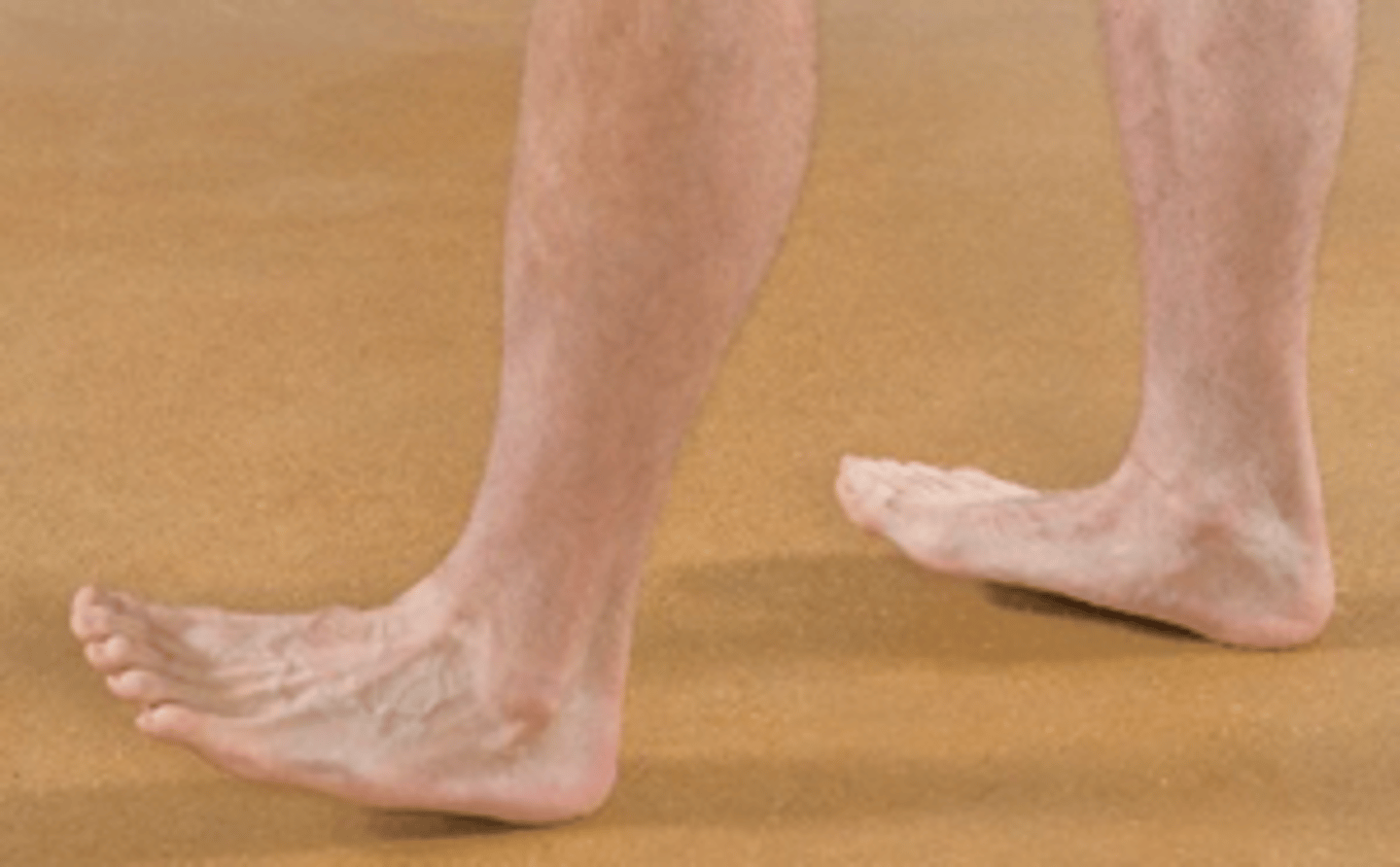 <p>Heel walk is indicative of _____ weakness with _____ nerve involvement</p>