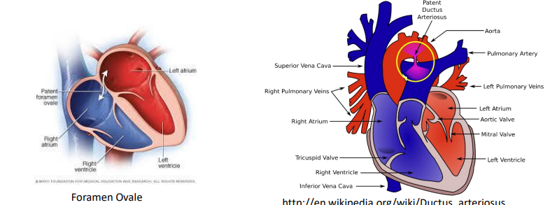 <ul><li><p>Lungs are partially collapsed - not involved in ventilation</p></li><li><p>High vascular resistance in the fetal lungs</p><ul><li><p>not yet functioning for gas exchange</p></li></ul></li><li><p>Blood shunting occurs:</p><ul><li><p>From the right atrium to the left atrium through the Foramen Ovale</p></li><li><p>From the pulmonary artery to the aorta through the Ductus Arteriosus</p></li></ul></li></ul><p></p>