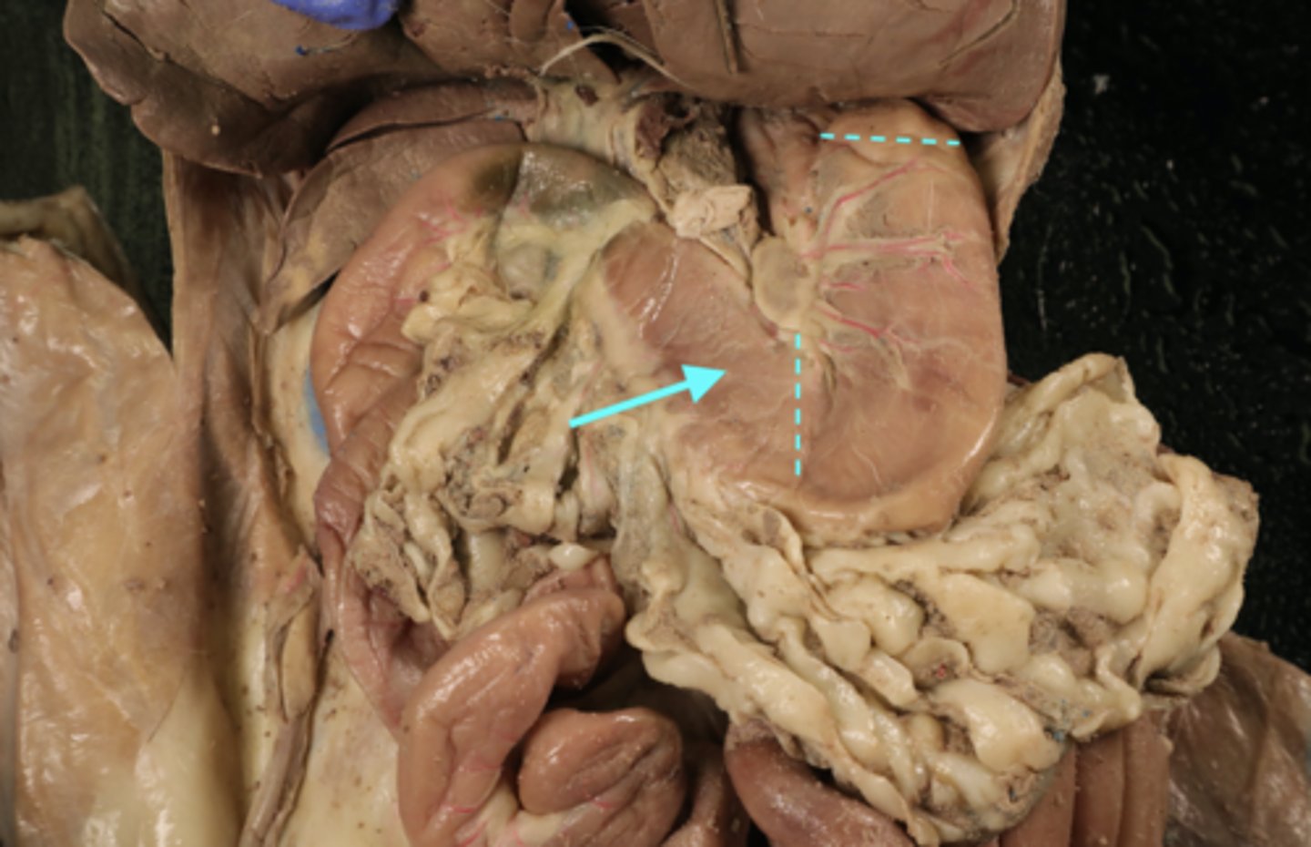 <p>name this part of the organ</p>