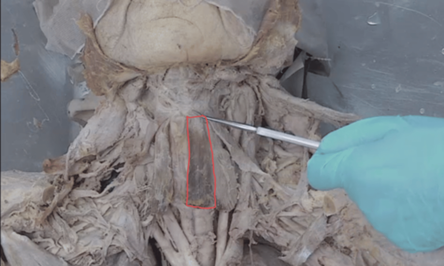 <p>identify this muscle</p>