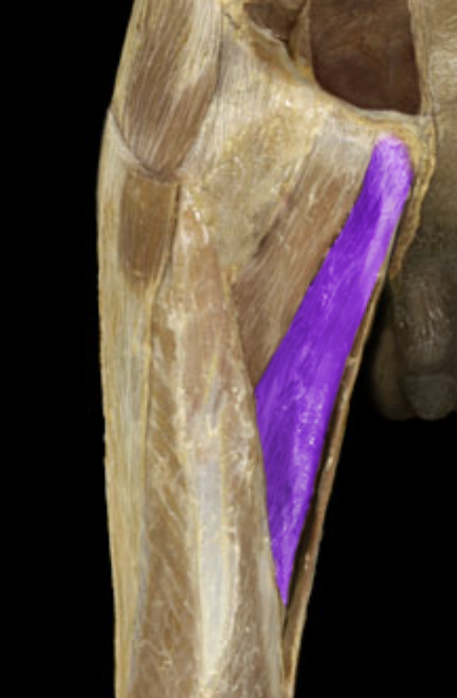 <p>What is the action of this muscle?</p>