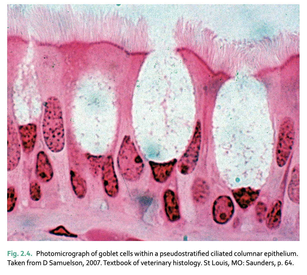 <p>ONLY ONE LAYER, but appears mutilayered bc of irregular nuclei (found in trachea)</p>
