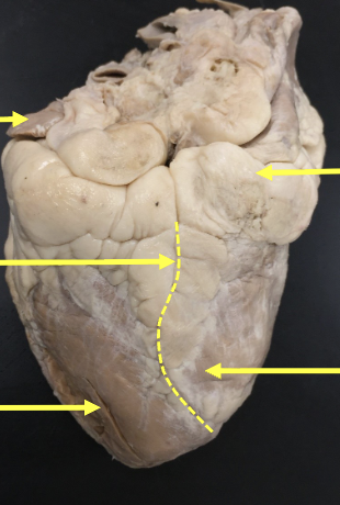 <p><br>is this the anterior view or posterior view<br>label from top to bottom&nbsp;</p>