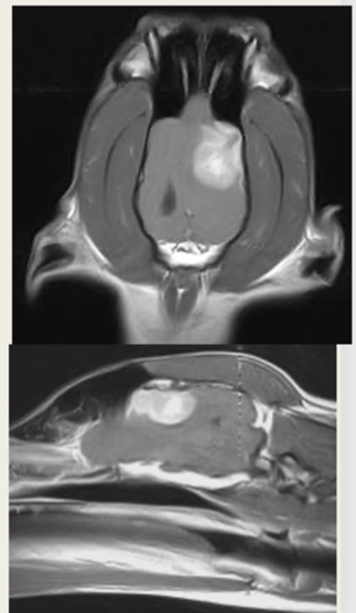 <p>is this an MRI or CT?</p>