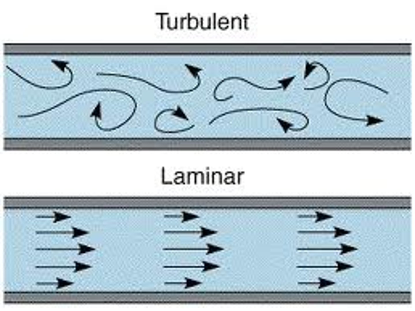 <p>Tuburlent</p>