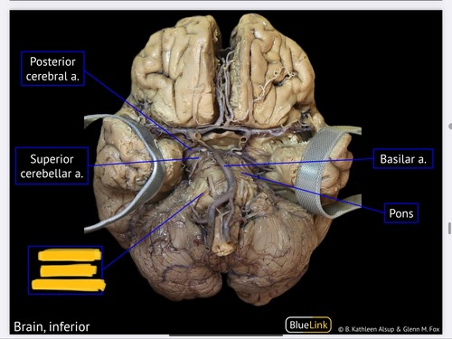 knowt flashcard image
