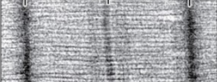 <p>What does not narrow during muscular contraction?</p><p>*contracted sarcomere</p>