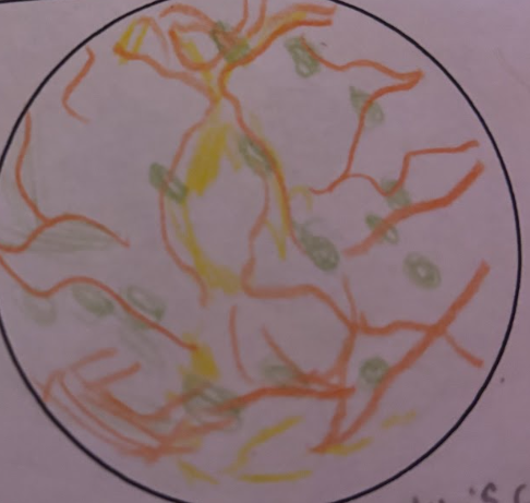 <p>The cell body is compact with dendrite extending from one side to receive sensory input and another axon extends the opposite to transmit a signal.</p>