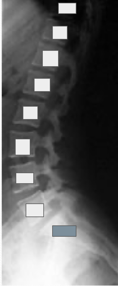 <p>What structures are referenced by the grey boxes?</p>