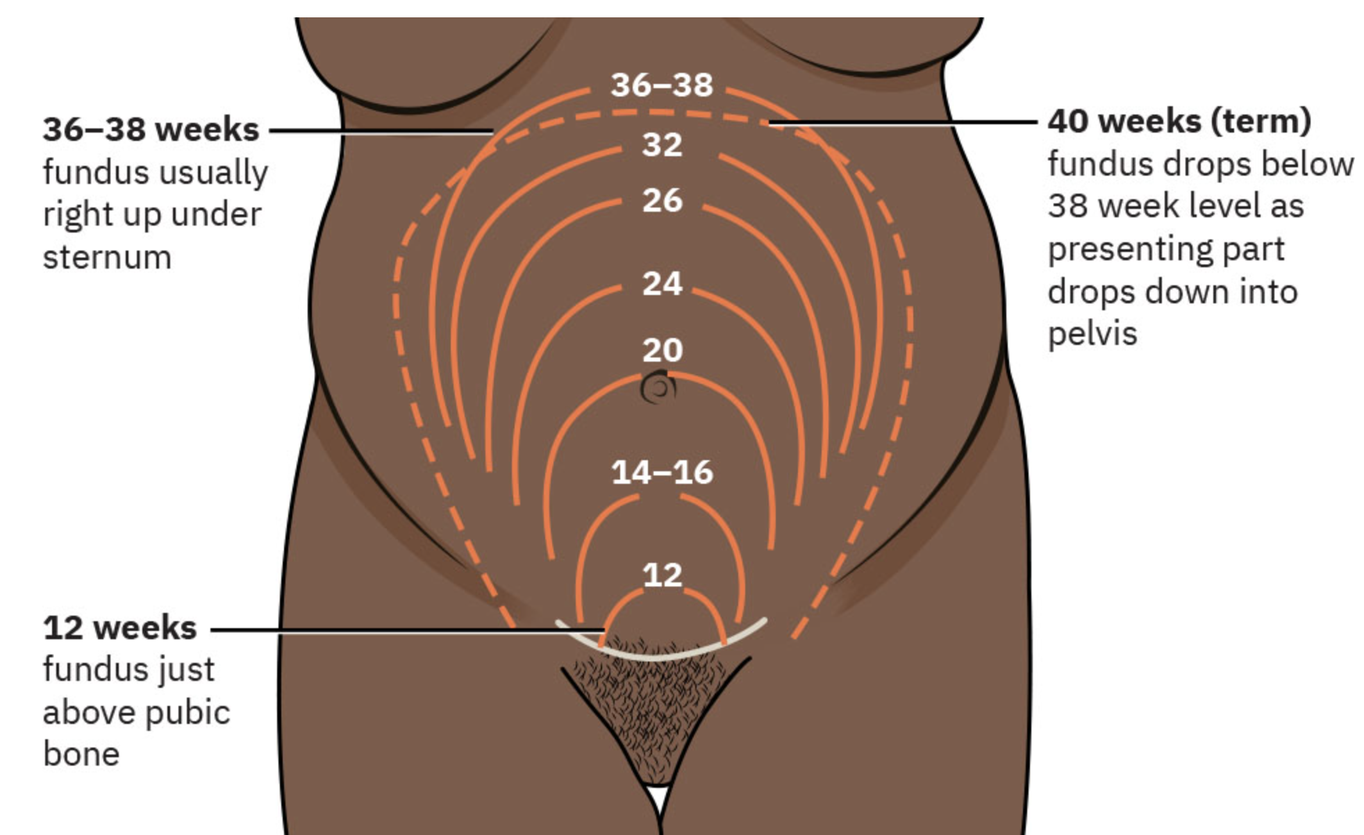 <p>Reflect weeks pregnant +/- 2 cm </p>