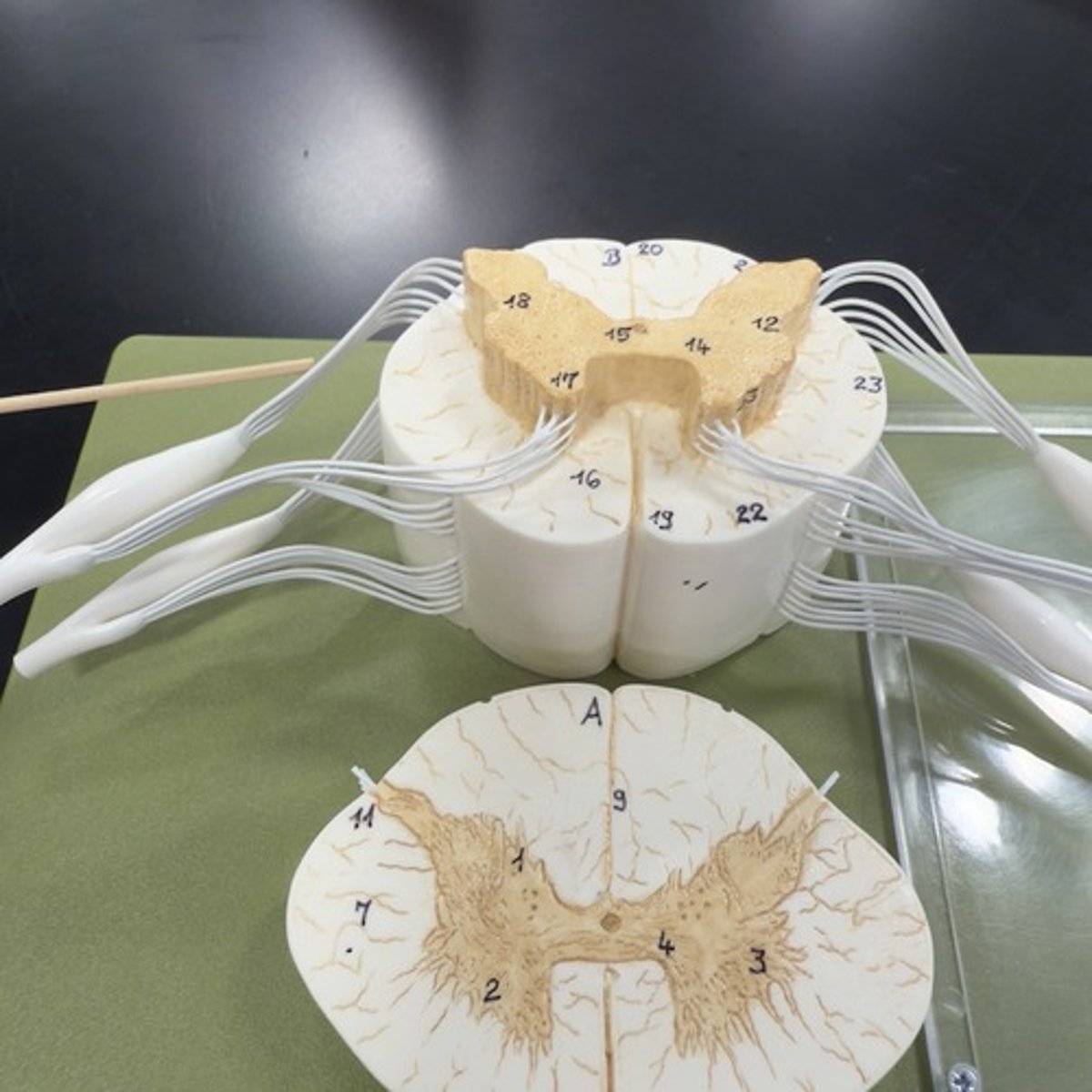 <p>Identify the structure.</p>