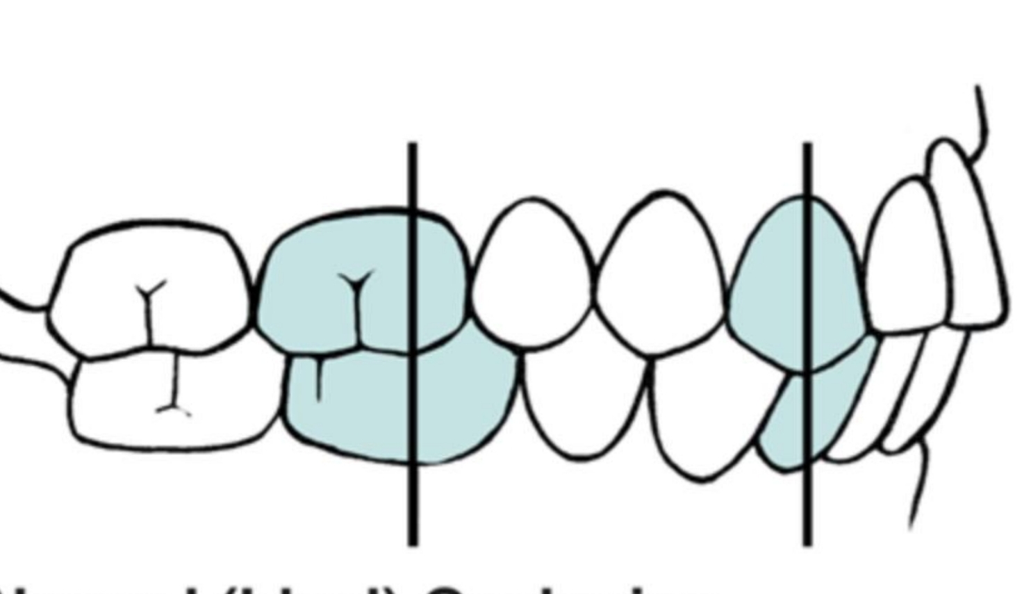 <p>Coming together of teeth (contacting in function)</p><p></p>